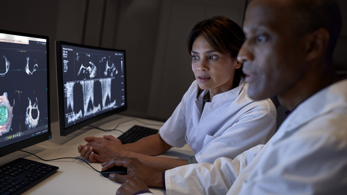 Los cardi&oacute;logos comprueban las exploraciones en el monitor