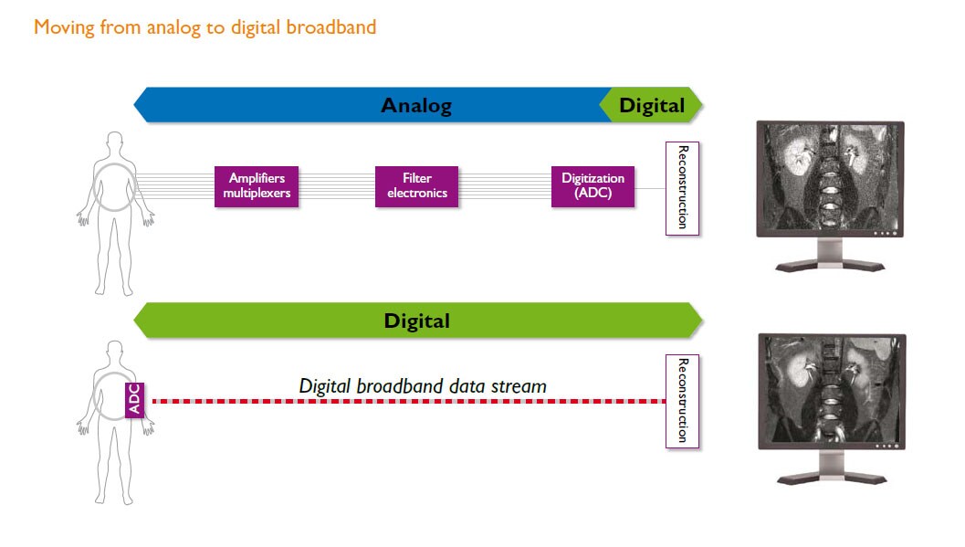 Banda ancha análoga a digital dStream