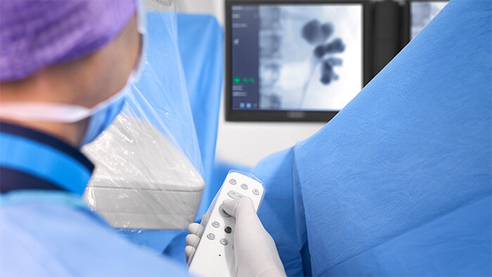 Arcos en C móviles para gastroenterología / urología