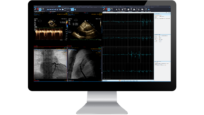 Pantalla de la interfaz del módulo de diagnóstico de cardiología en un monitor