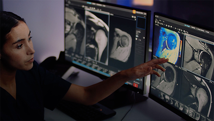 miniatura de calidad de imagen