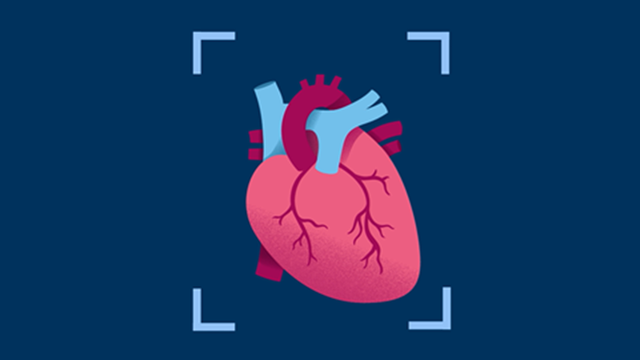 V&iacute;deo del Cardiac CT 5300
