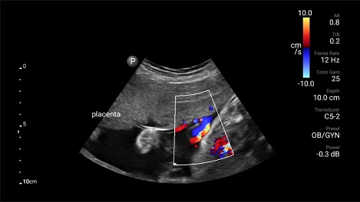 Obstetricia y gineco en miniatura