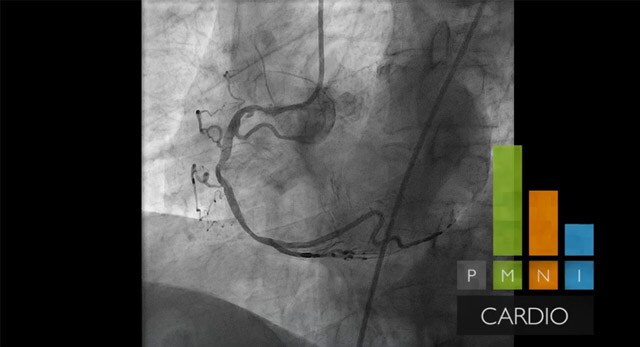 Ver con confianza cada vez que durante las intervenciones complejas