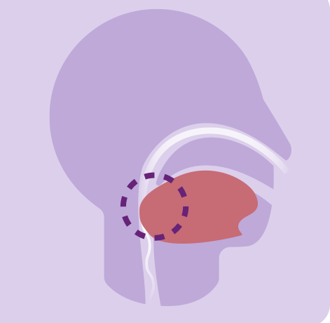 diagrama-de-la-apnea-de-sue&ntilde;o