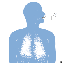 Cámara espaciadora en aerosol - Inhalador compacto para asma con máscaras  (apto para niños y adultos) (2)